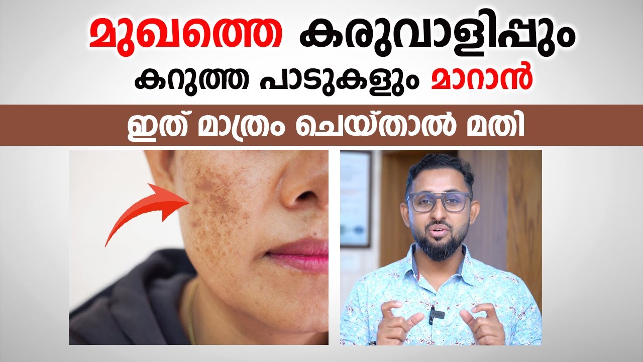 മുഖത്തെ കരുവാളിപ്പും കറുത്ത പാടുകളും മാറാൻ simple trick | Face whitening tips | Arogyam