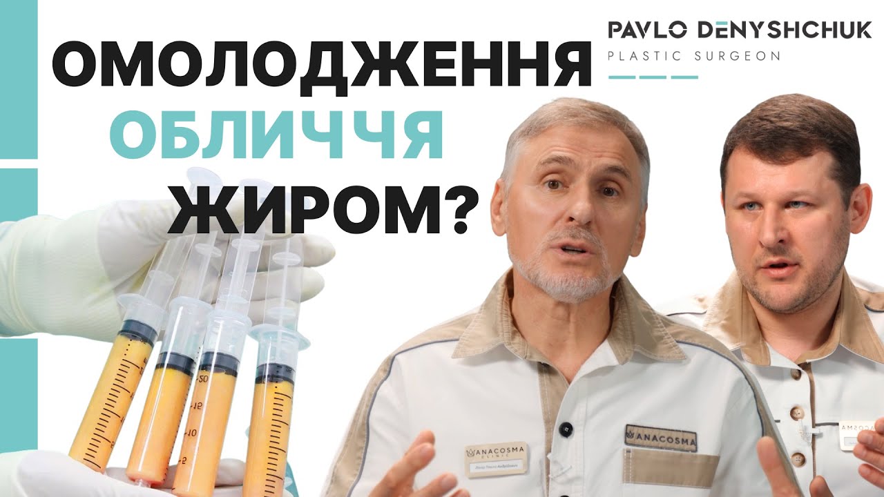 ЛІПОФІЛІНГ ОБЛИЧЧЯ ЗАМІСТЬ ФІЛЕРІВ? НОВИЙ ТРЕНД