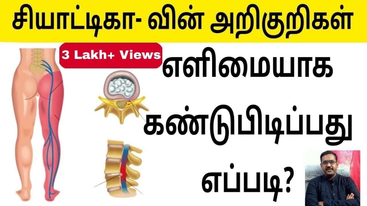 HOW TO SELF CHECK SCIATICA?  ஸ்கையாட்டிகா அறுவை சிகிச்சை இல்லாமல் சன் பிசியோதெரபி | Dr Jeyachandran