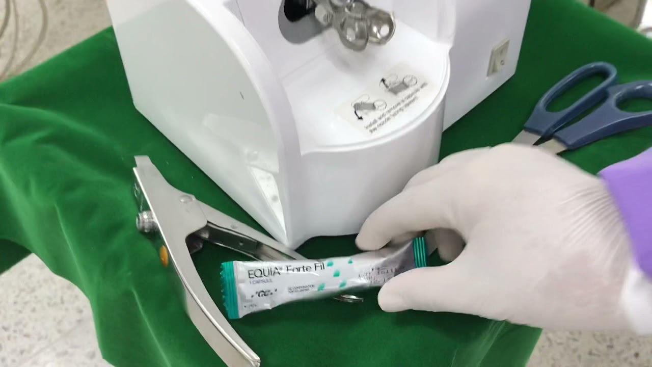 Equia forte Fill  Glass ionomer cement mixing by Assoc.Prof.Saijai Tanthanuch