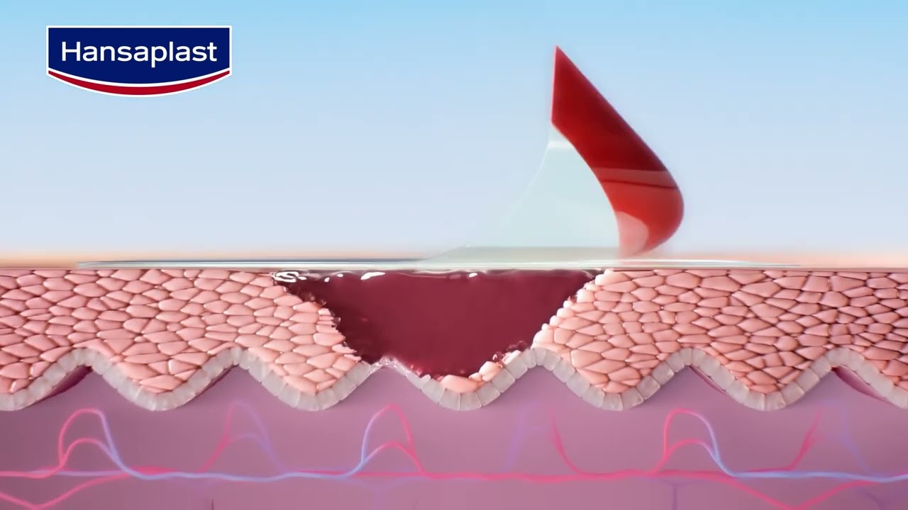 Inside the Next-Gen Hansaplast Plaster | How Healing Happens with Hydrocolloid