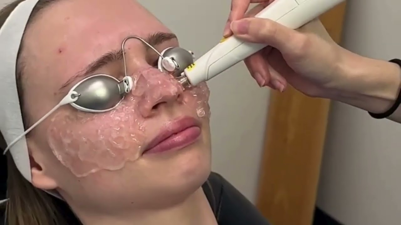 Dr. C. Lisa Prokopich on intense pulsed light and amniotic membrane therapies for dry eye disease