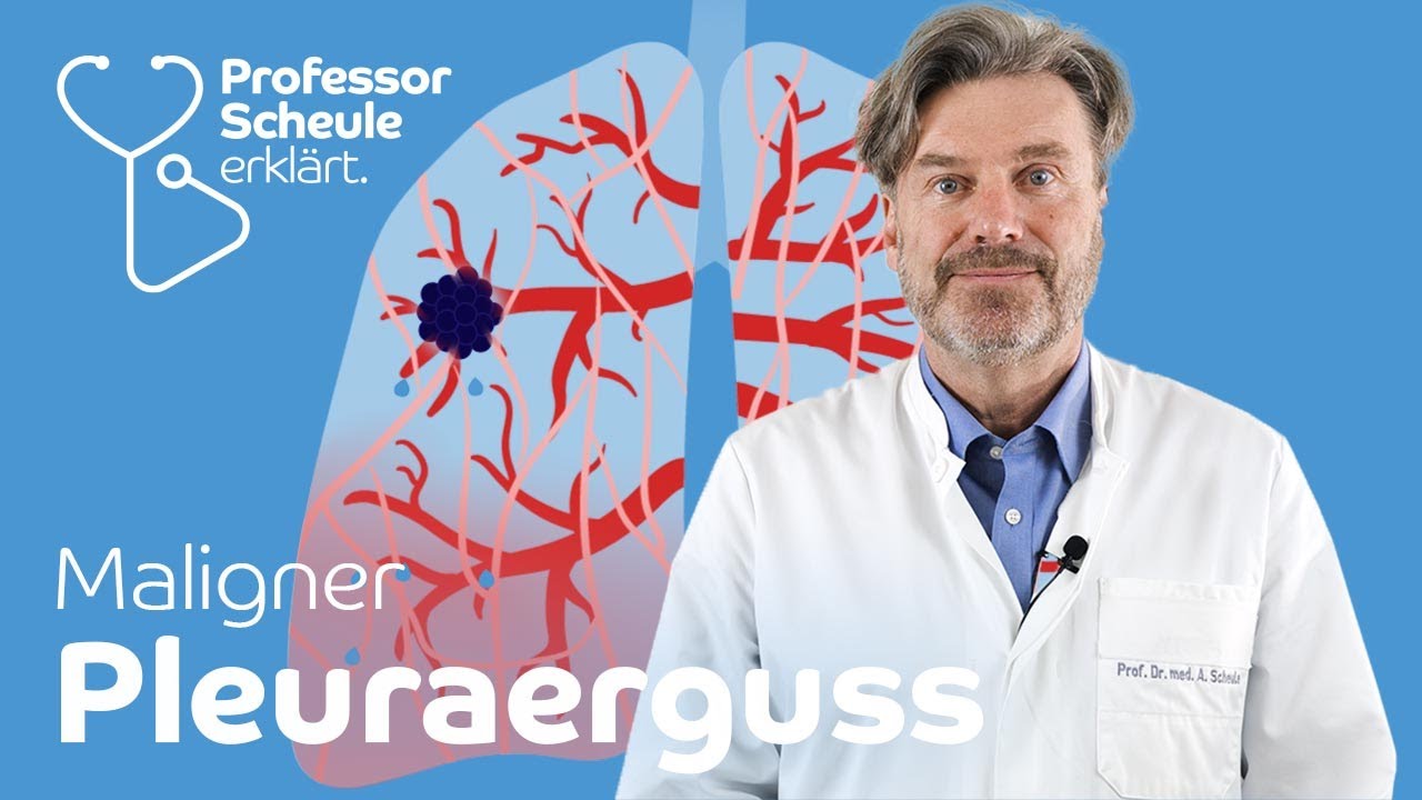 Was ist ein maligner Pleuraerguss (Wasser in der Lunge) – Professor Scheule erklärt einfach