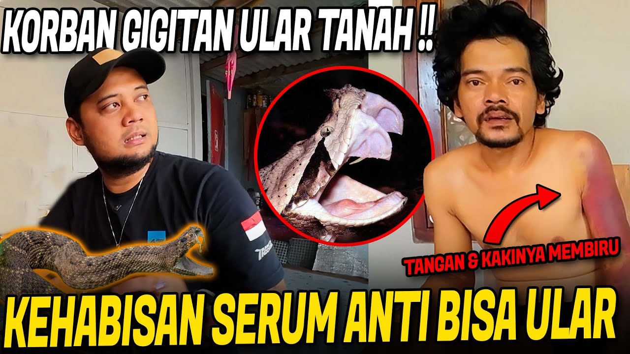 NOLONG KORBAN GIGITAN ULAR VIPER TERPARAH!! BENGKAKNYA UDAH SAMPE BADAN