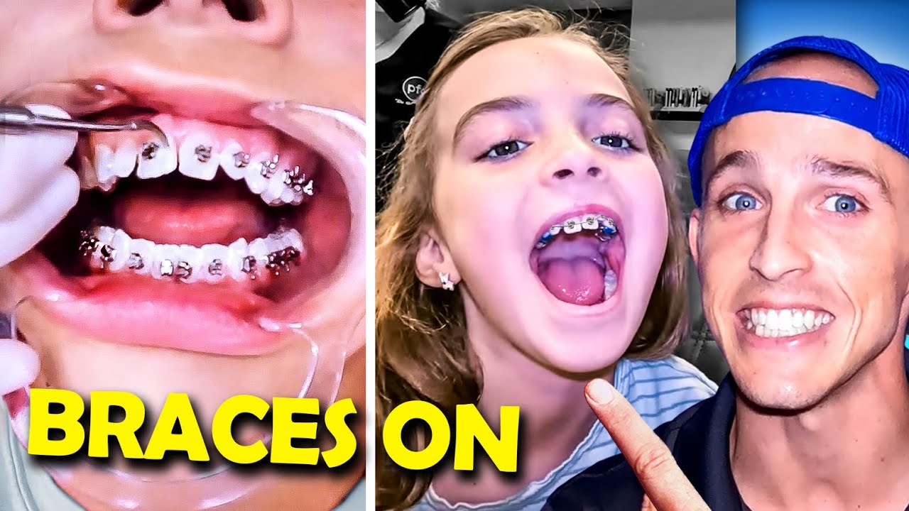 Getting braces...? 3 Questions you ask before you start orthodontic treatment..