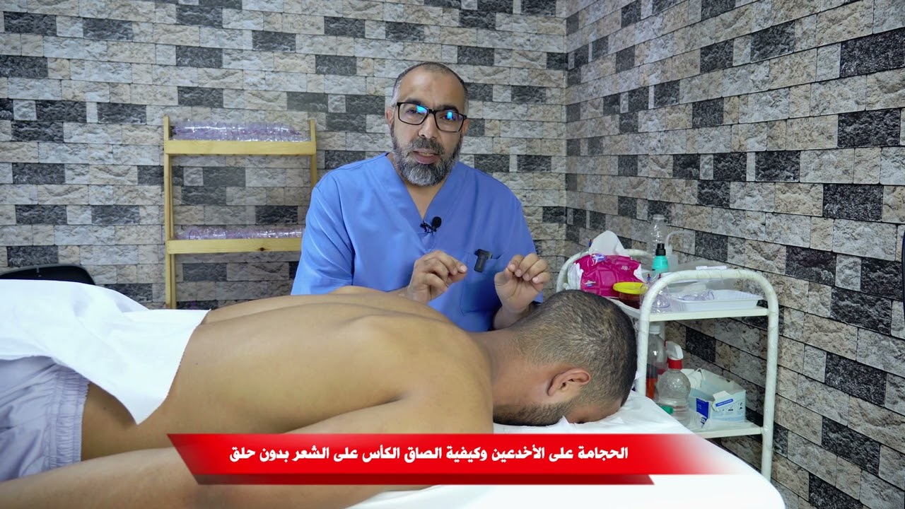 الحجامة على الأخدعين مكانهما الصحيح وطريقة الصاق الكأس بدون حلق للشعر