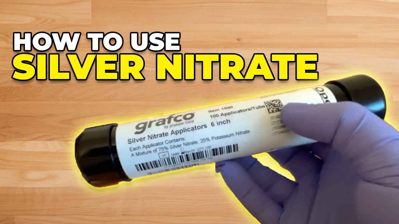 How to use silver nitrate