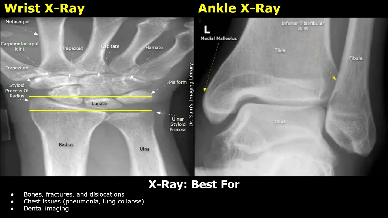 The Difference Between Ultrasound, X-Ray, CT Scan & MRI | How They Work, Advantages & Disadvantages