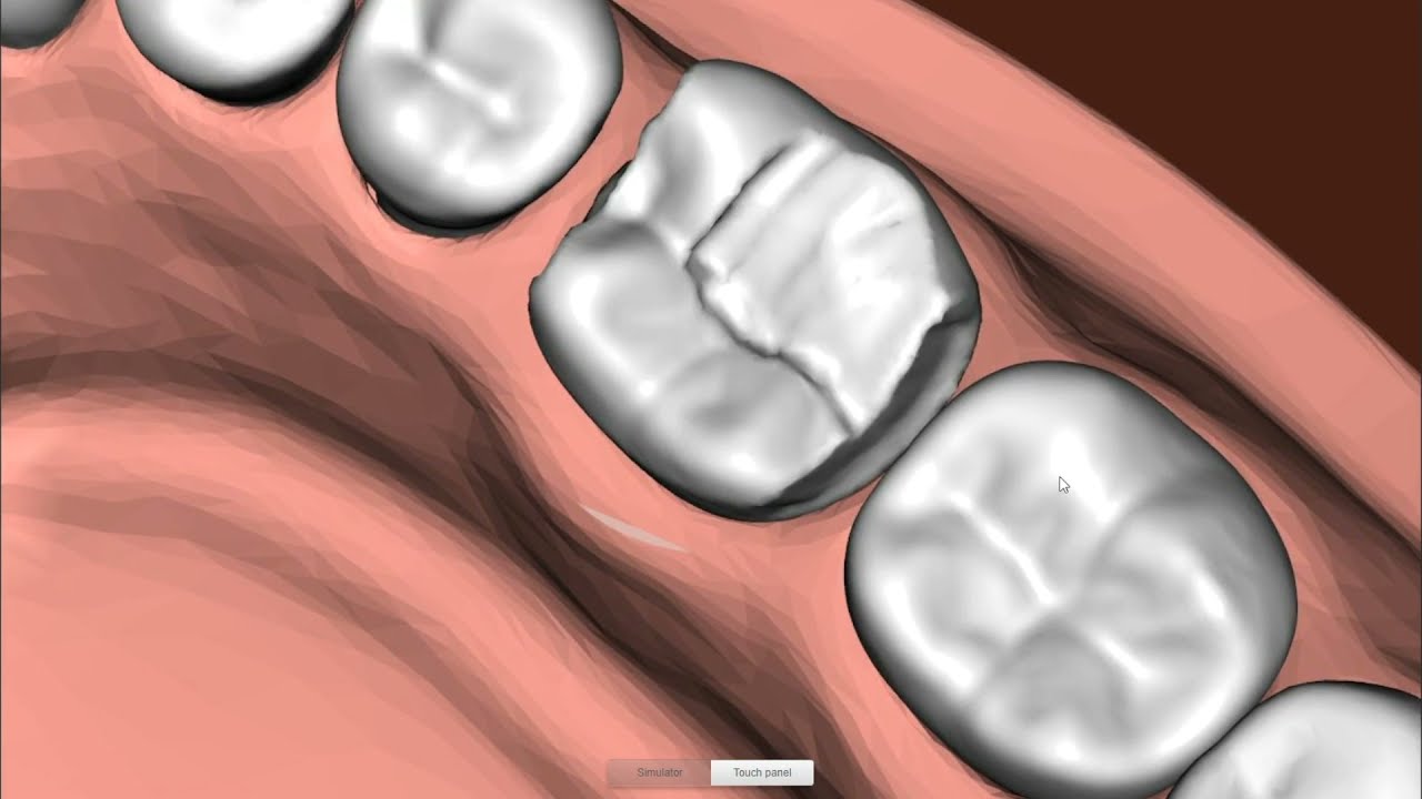 #46 Occlusal reduction demo | Simodont Dental Trainer