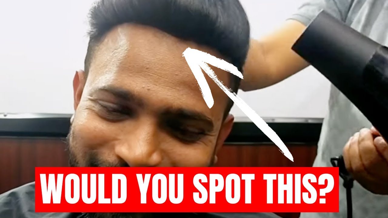 Hairline Back in 20 Minutes?! | Frontline Hair System Review