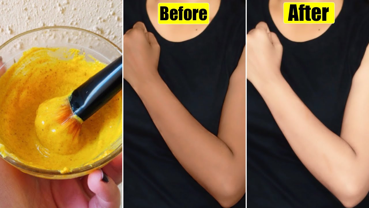 बरसों की Tanning कालापन करे साफ़-1 Day-DeTan Challenge- Whiten Dark Body Parts-रंग निखारे-1 Use में