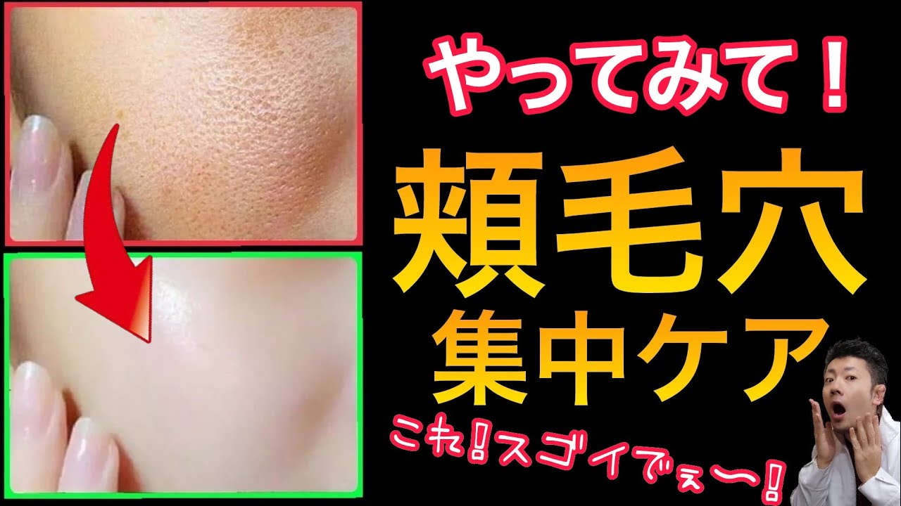 【毛穴が消える】頬の毛穴の集中ケア方法！【肌がきれいになる】自宅でできる毛穴をなくす方法！【美肌スキンケア】【乳化洗顔】