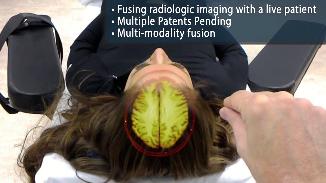 OpenSight Augmented Reality Surgical Planning | Novarad