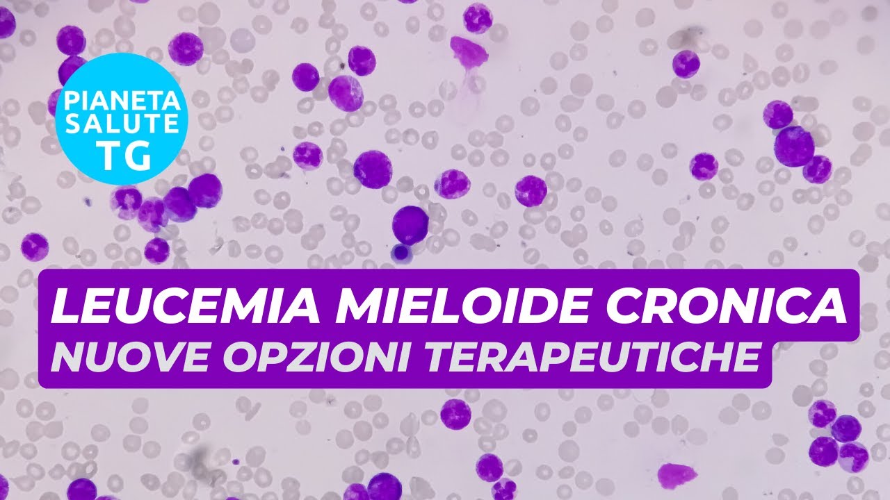 Nuove opzioni terapeutiche per il trattamento della leucemia mieloide cronica (LMC)