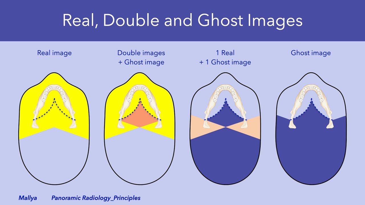 Principles of Panoramic Image Formation II&mdash;Real, double, and ghost images