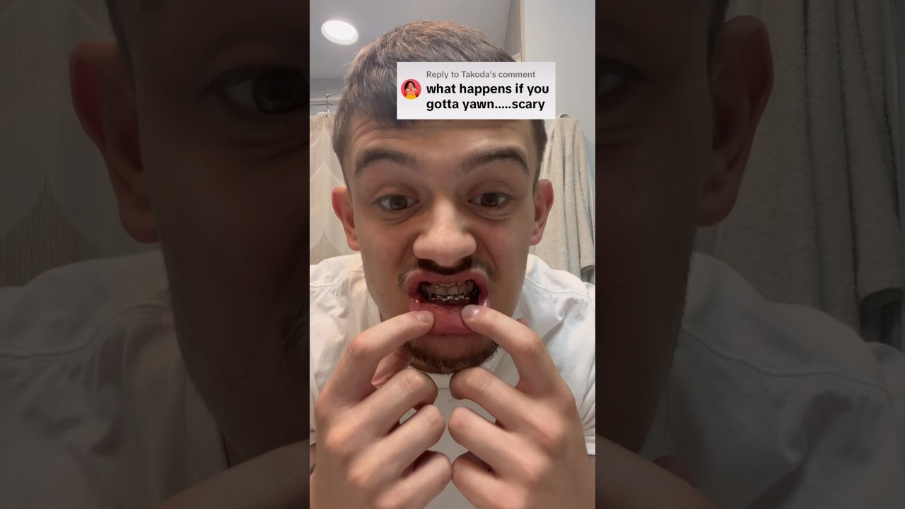 Зеваю с заклеенным ртом! 🤐🥱