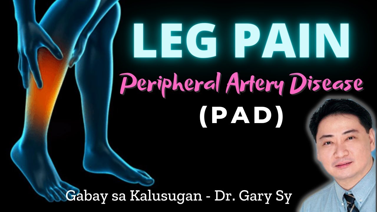 Leg Pain: Peripheral Artery Disease (PAD) - Dr. Gary Sy