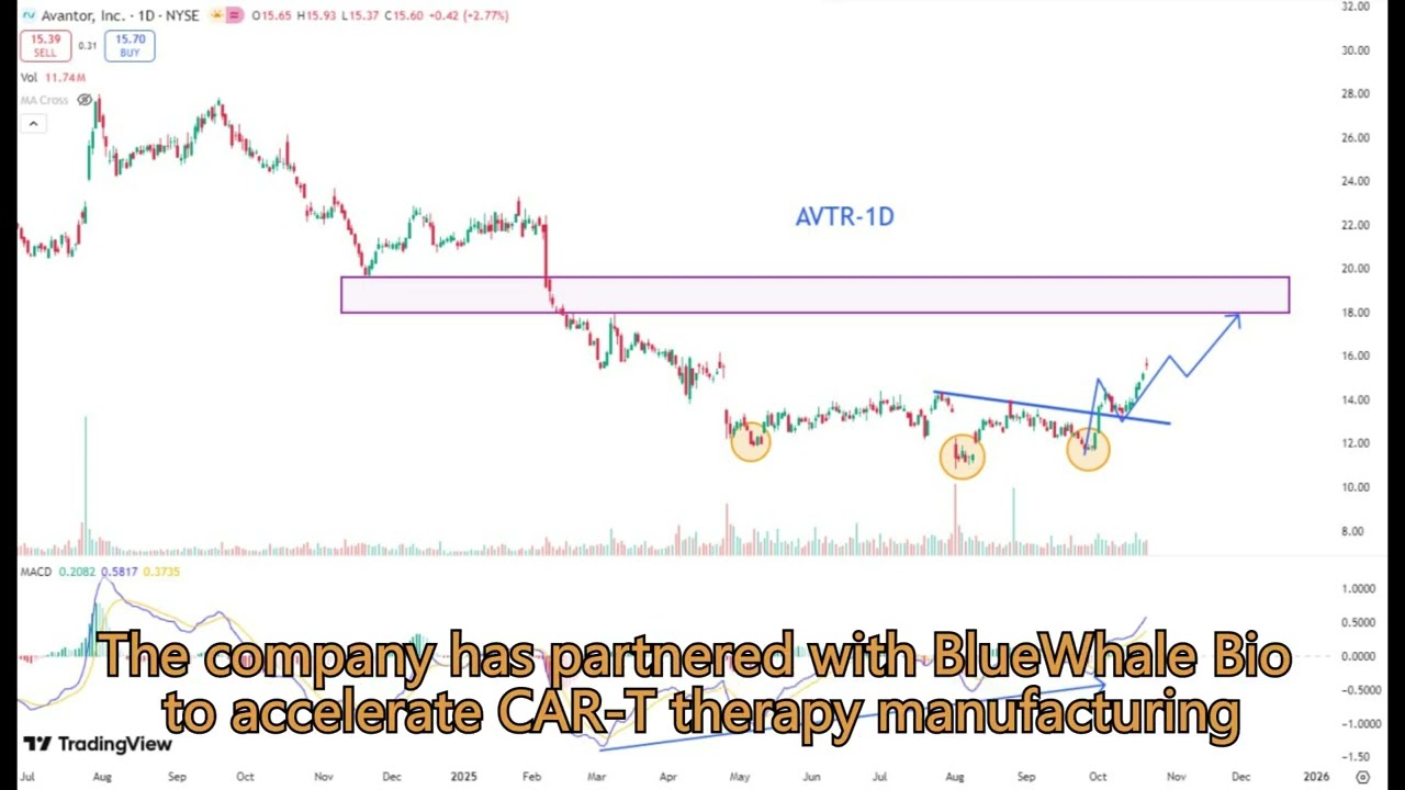 💡Oct 22 Stock Pick #AVTRB #Stocks #Investing #AVTR