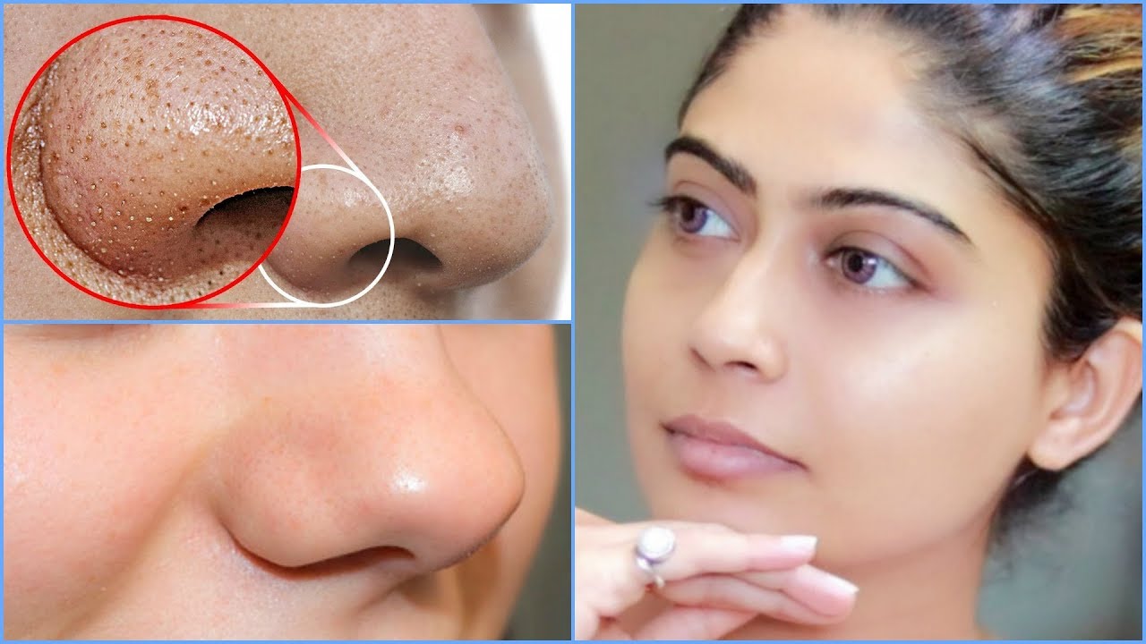How To do Facial Cleanup At Home | Rinkal Soni