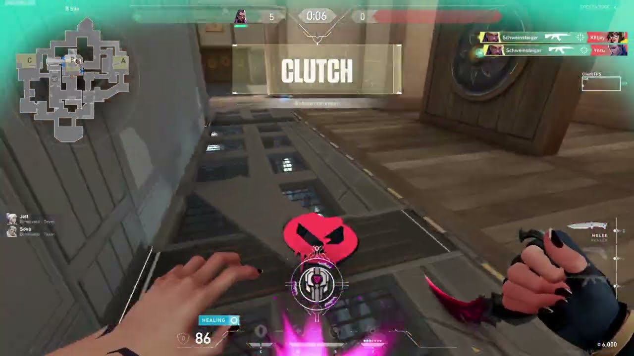 순수실력 아섭 300페이지 발로란트 매드무비