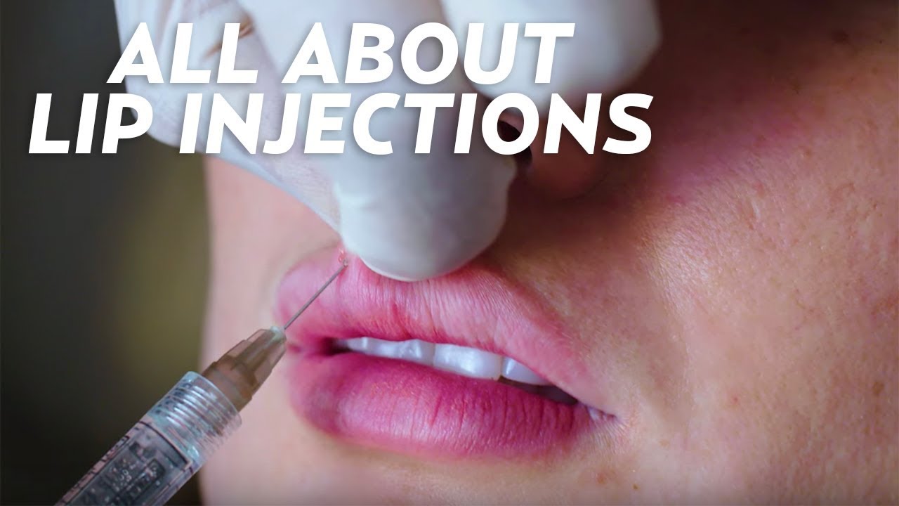 Lip Filler Questions: What I Wish I Knew! | Beauty with Susan Yara