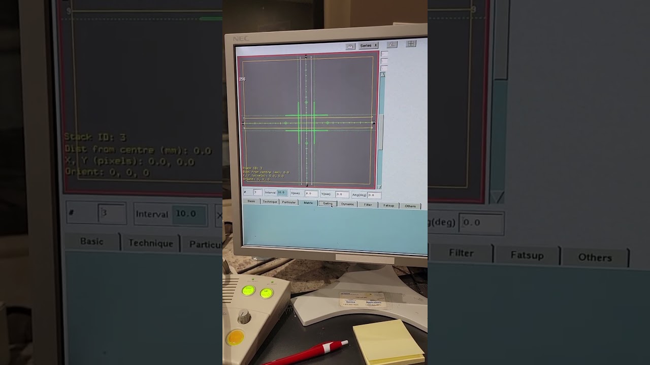 How to Scan a knee on a Hitachi .3 MRI scanner part 1