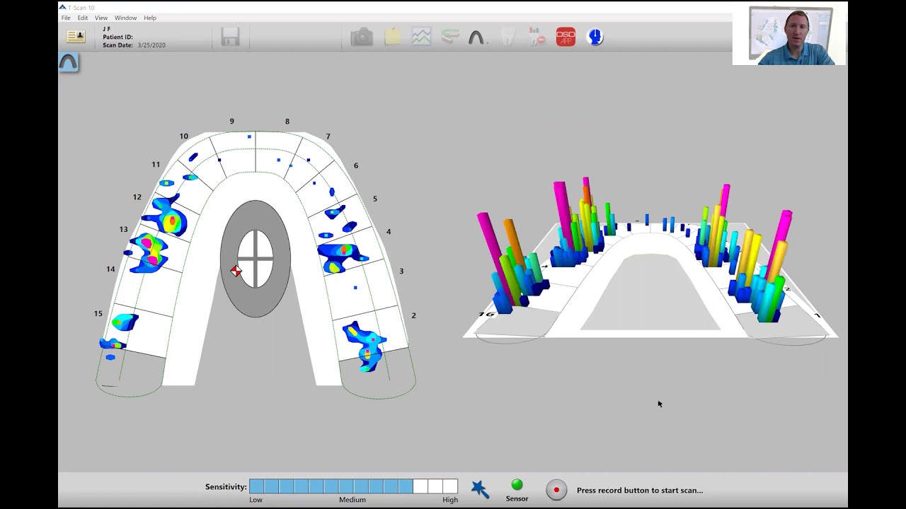 How to Set T-Scan Sensitivity and Record Patient Data