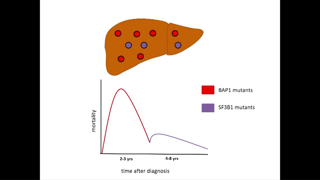 Metastatic Mechanisms of Uveal Melanoma – the Zimmerman Effect by Hans Grossniklaus, MD