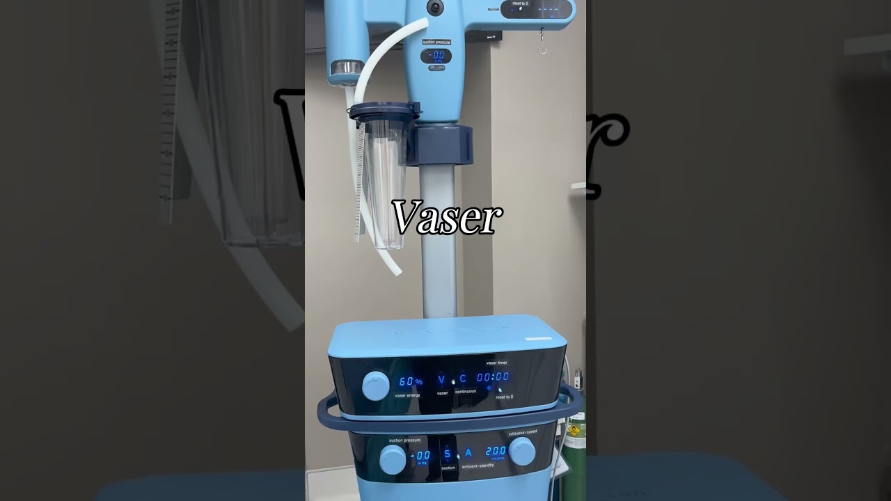 Vaser Liposuction: Precise Fat Removal, Minimal Downtime #vaserliposuction