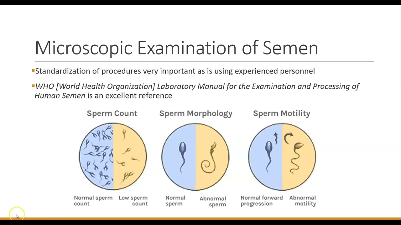 Ch 12 Seminal Fluid Analysis