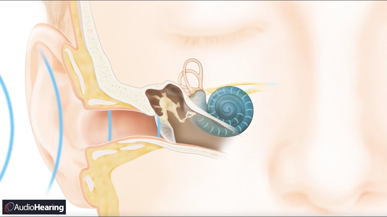 How Natural Hearing Works - Cochlear Implantable Hearing Solutions