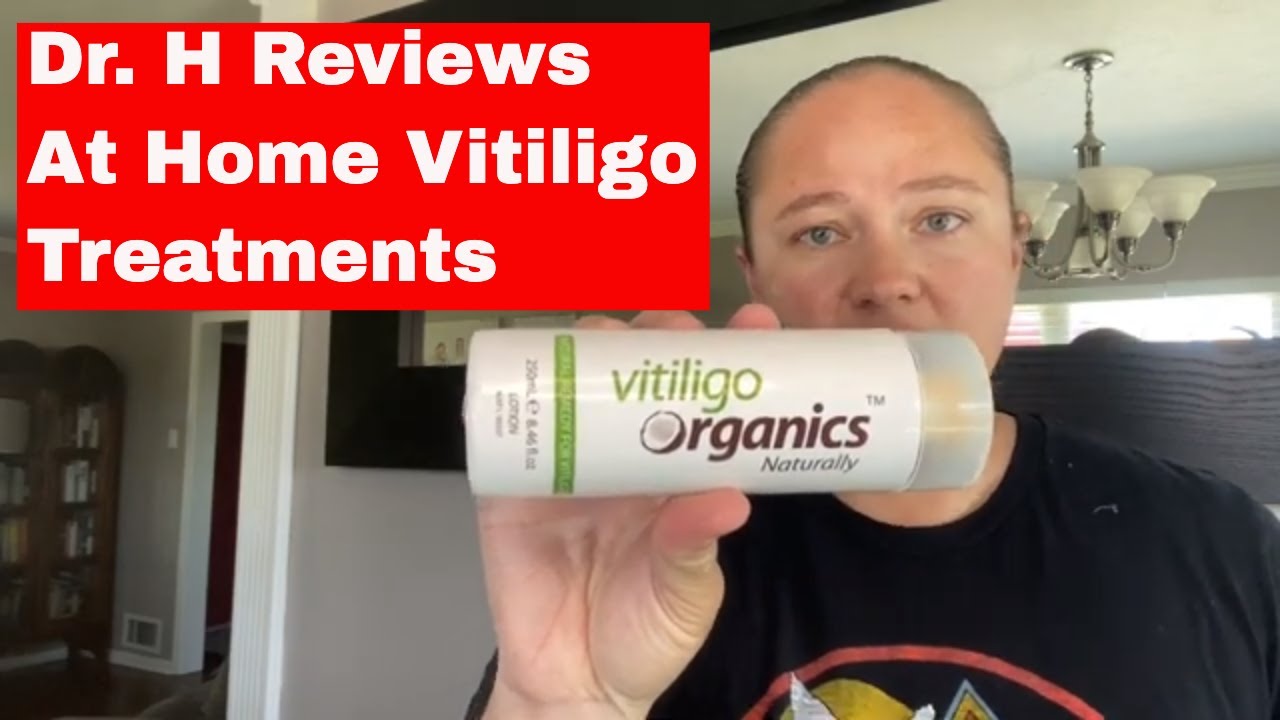 Dr. H Reviews At Home Vitiligo Treatments | Vitiligo Cream