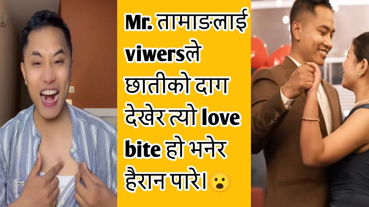 Mr. तामाङलाई viwersले छातीको दाग देखेर त्यो love bite हो भनेर हैरान पारे।😮