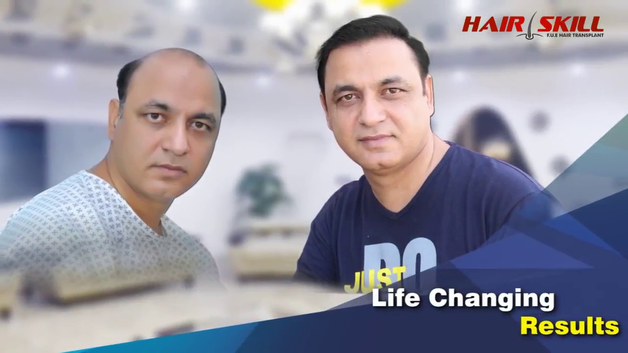 Hair Skill || Best hair transplant clinic in Pakistan || Call Now +92 300 9418717