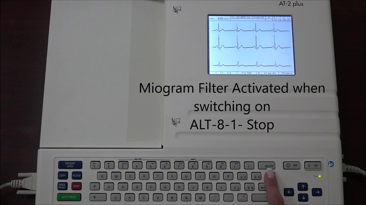 ECG At-2 Plus (Configuration) #ecg #ekg