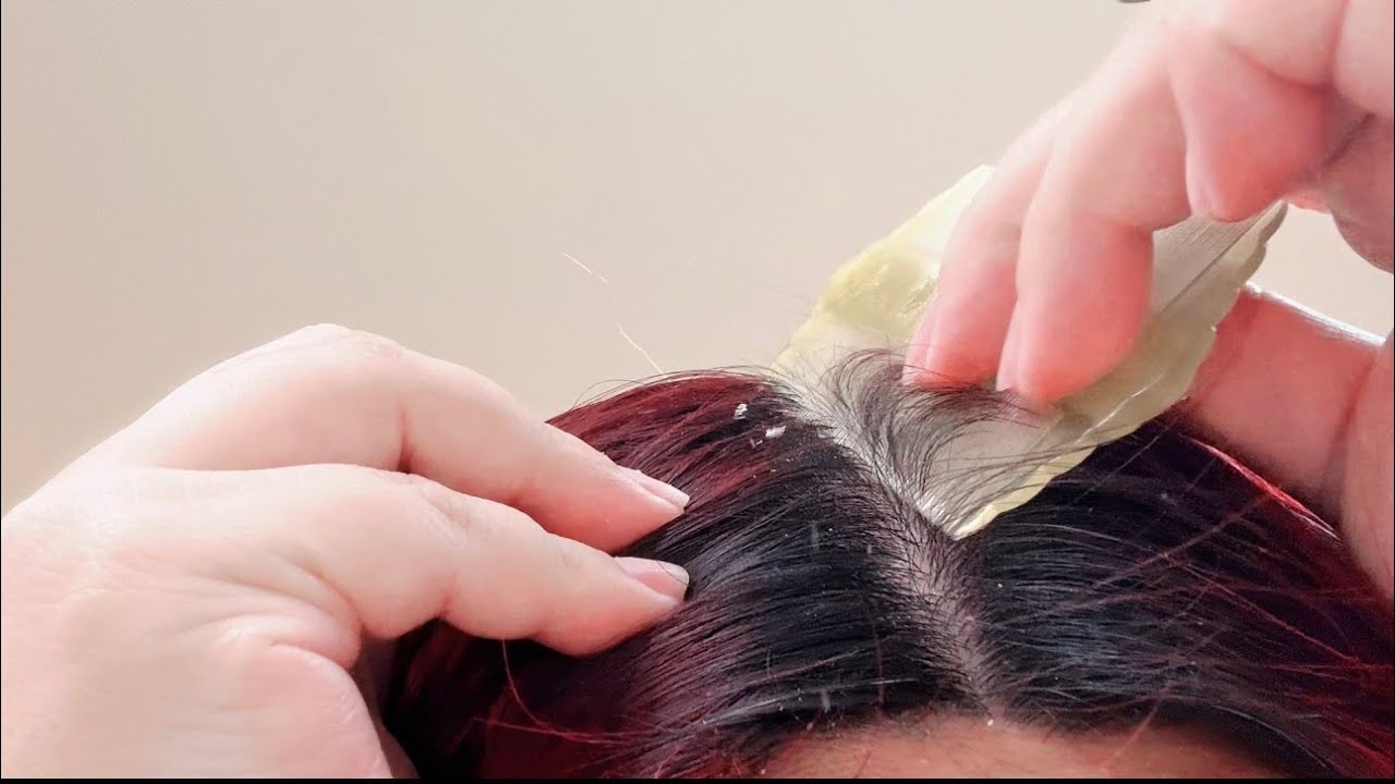 ASMR 🌟 Immersive Scalp Examination | Dandruff Cleaning | No Talking