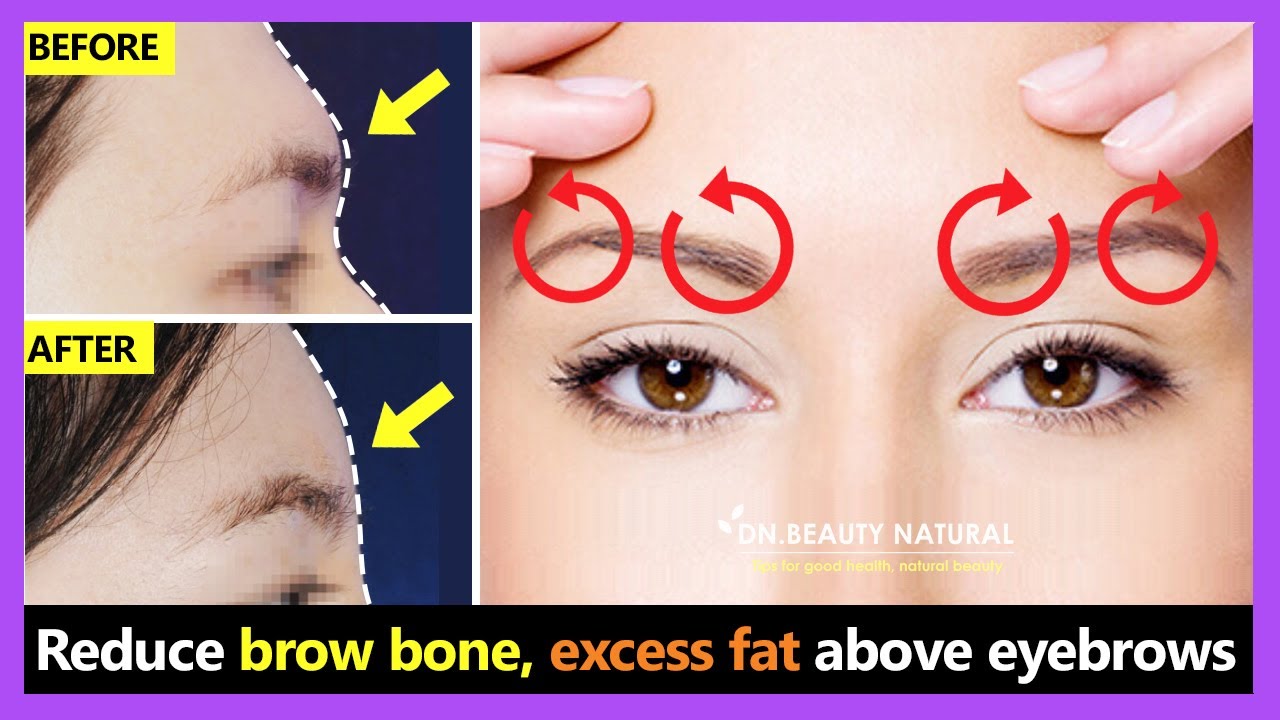 How to reduce Brow bone naturally and remove excess fat above the eyebrows with Exercise & Massage