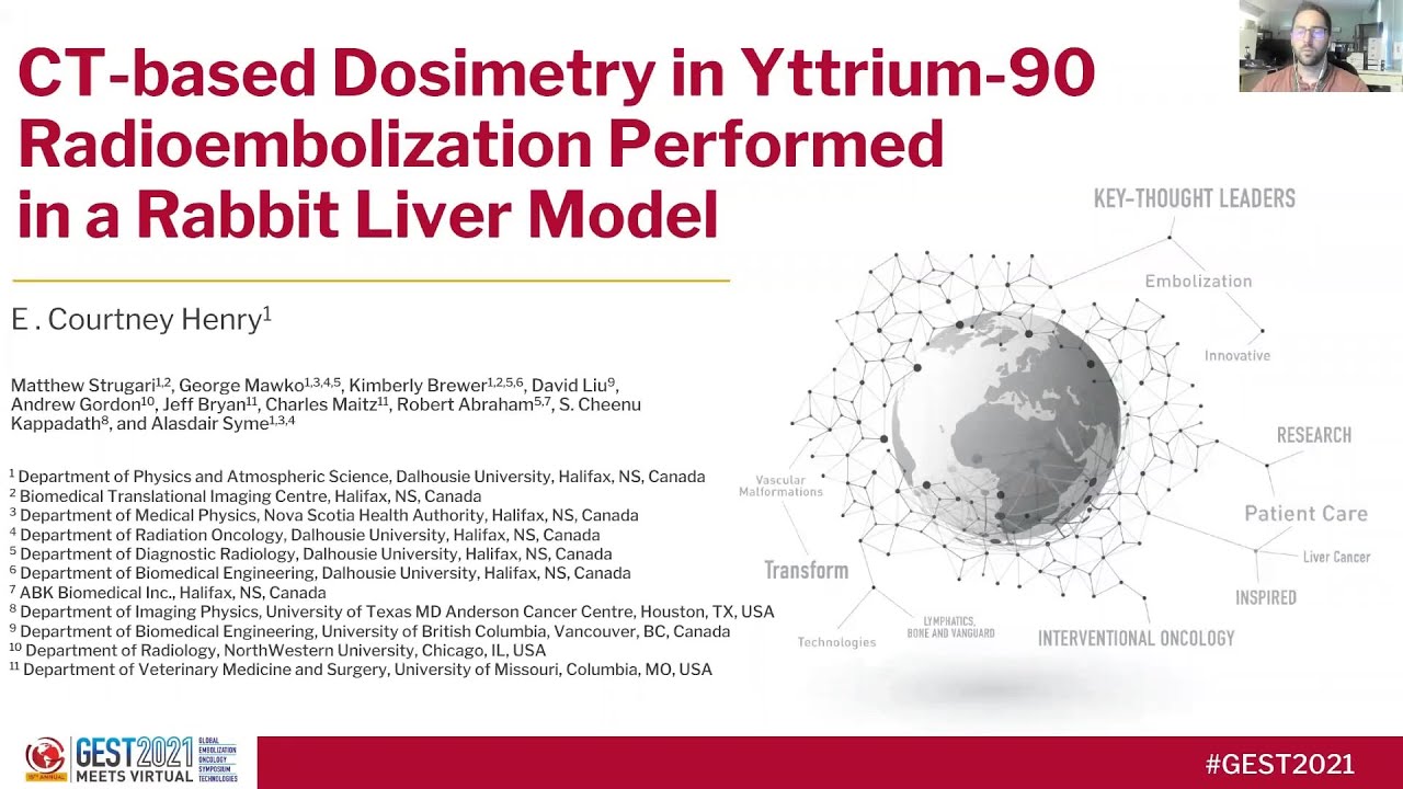 CT-based Dosimetry in Y-90 Radioembolization - Courtney Henry, Dalhousie University