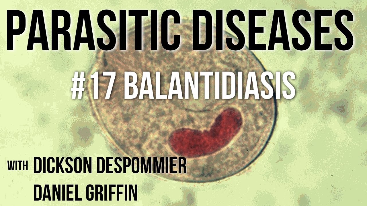 Parasitic Diseases Lectures #17: Balantidiasis