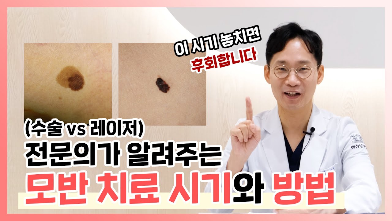 전문의가 알려주는 모반치료 시기와 방법 (수술 Vs.레이저) #선천성모반 #모반수술 #모반레이저