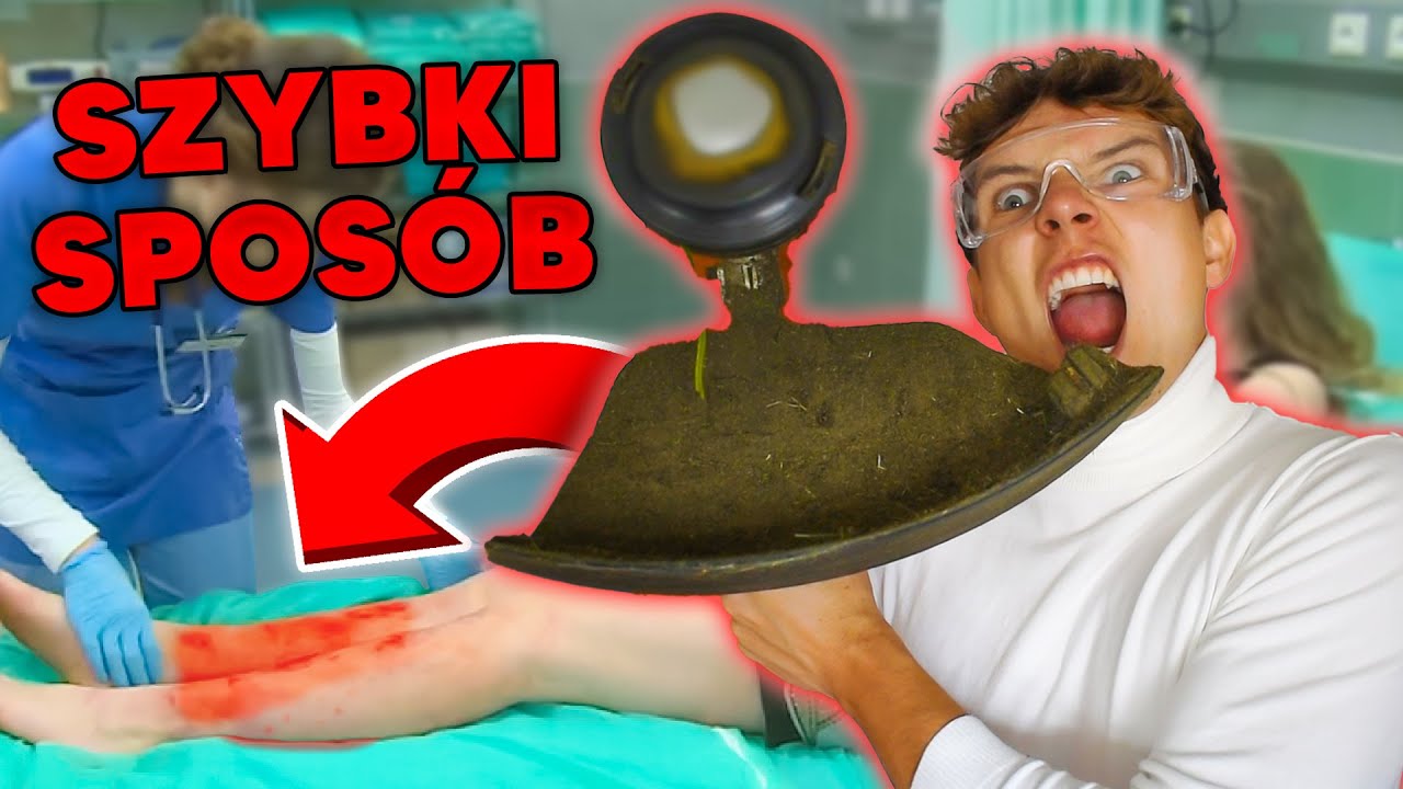 SZPITAL *ogoliła nogi kosiarką*