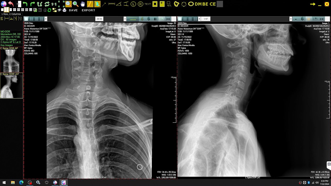 DDR (Dynamic Digital Radiography) Chiropractic X-Ray System from 20/20 Imaging