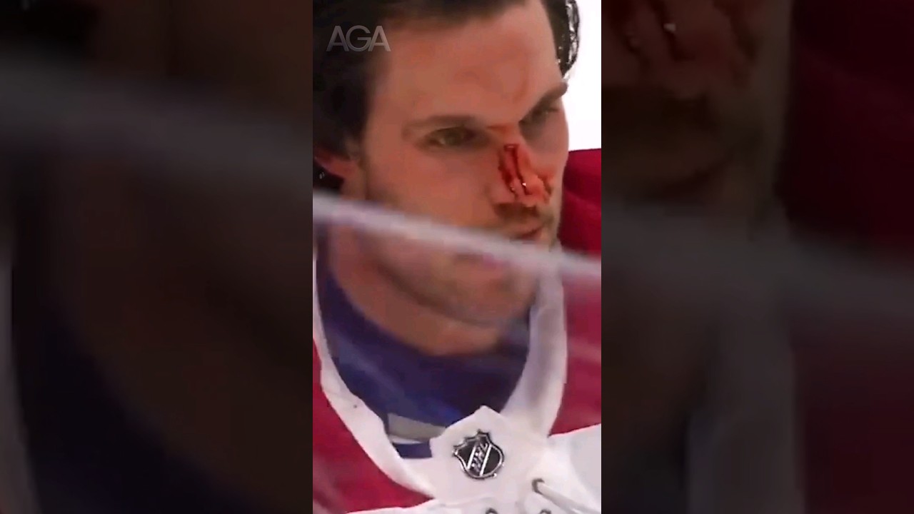 It's a crazy world we live in 🥊#boxing #boxinglife #hockey #hockeyfights