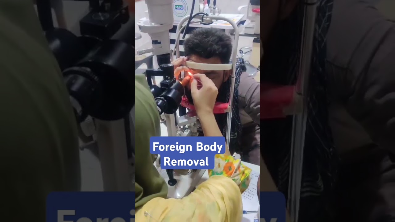 Foreign Body Removal Procedure: Safe Techniques & Best Practices