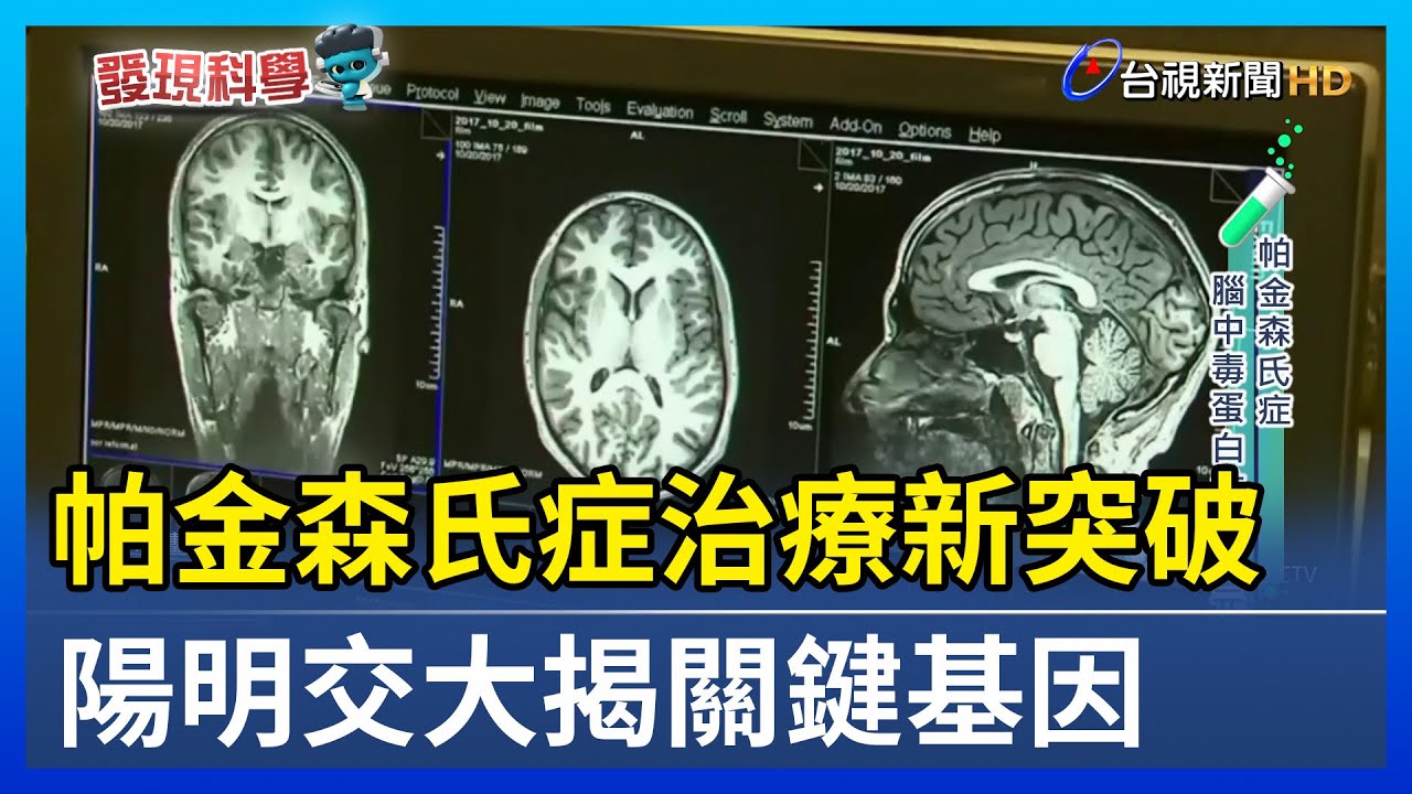 帕金森氏症治療新突破 陽明交大揭關鍵基因【發現科學】