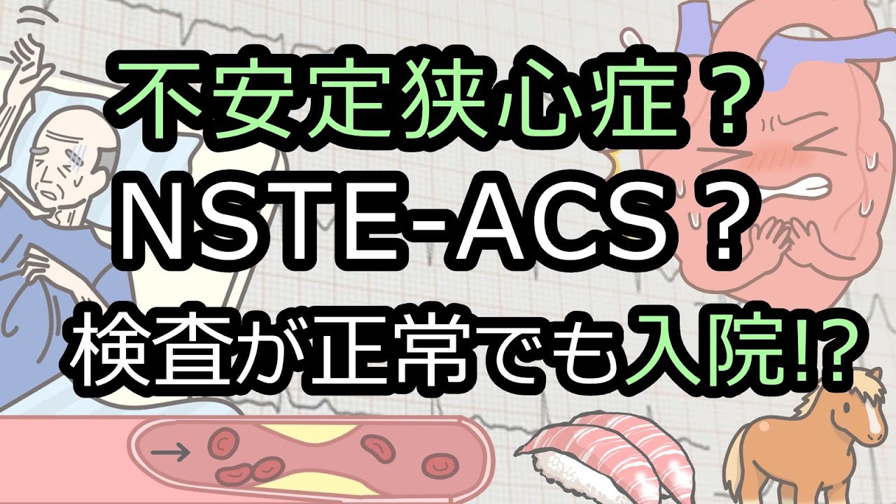 胸痛でACS[急性冠症候群]/狭心症を疑う時の診療の考え方