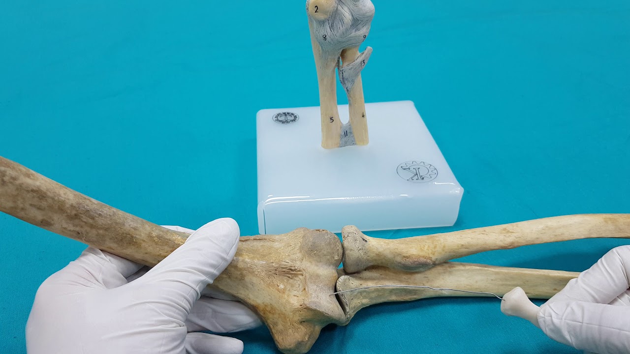 Üst Ekstremite Eklemleri-Art.Cubiti|Dirsek Eklemi Anatomisi (YENİ MAKET-YENİ VİDEO-1.Bölüm)