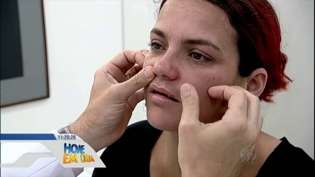 Transformação da Face: mãe de cinco filhos passa por mudança para ser madrinha de casamento