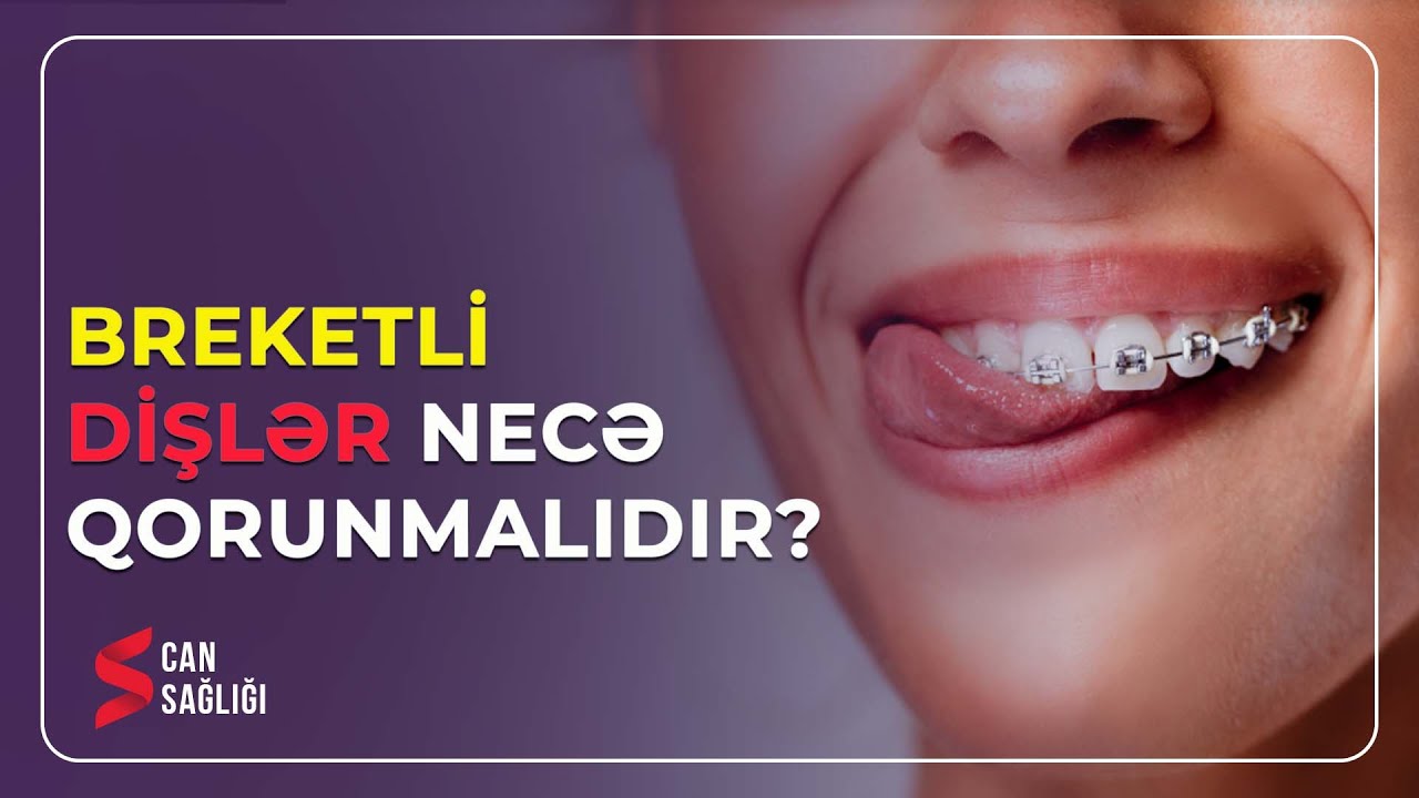 Breketli dişlər haqqında bilmədikləriniz (29.05.2023) - Medical Meida Live