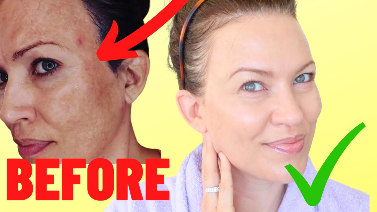 MELASMA A.M. & P.M. SKINCARE ROUTINE! When I do THIS, my skin is better in 3 months!